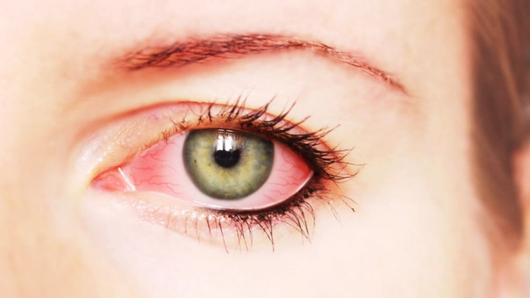 علاج مضاعفات السكر على الشبكية